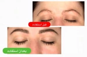 نتیجه تقویت ابرو کرکسی